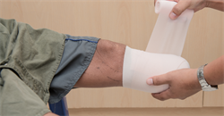 Aaron Haley v Newcold Ltd [2025] EWCC 57